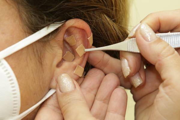 Auriculoterapia Corporativa